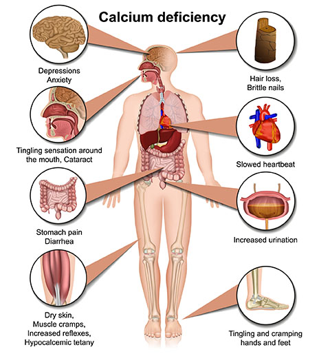 deficiency