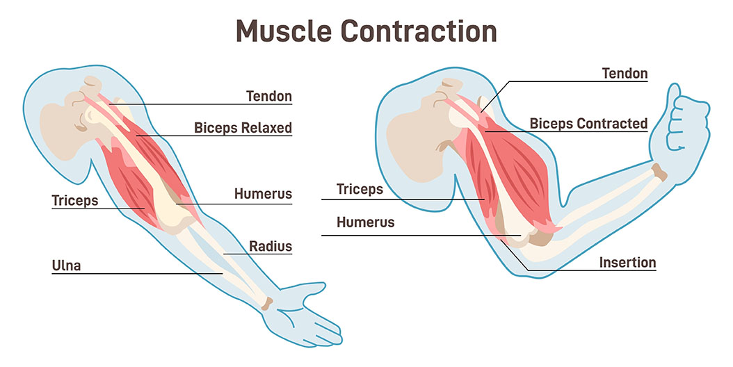 contraction